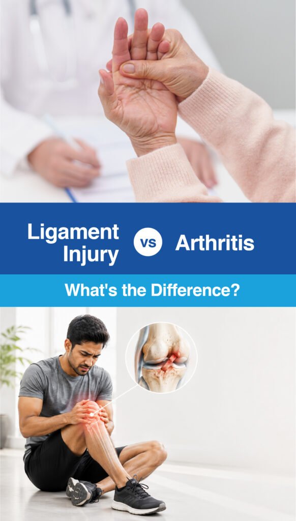 Ligament Injury vs Arthritis: What's the Difference?