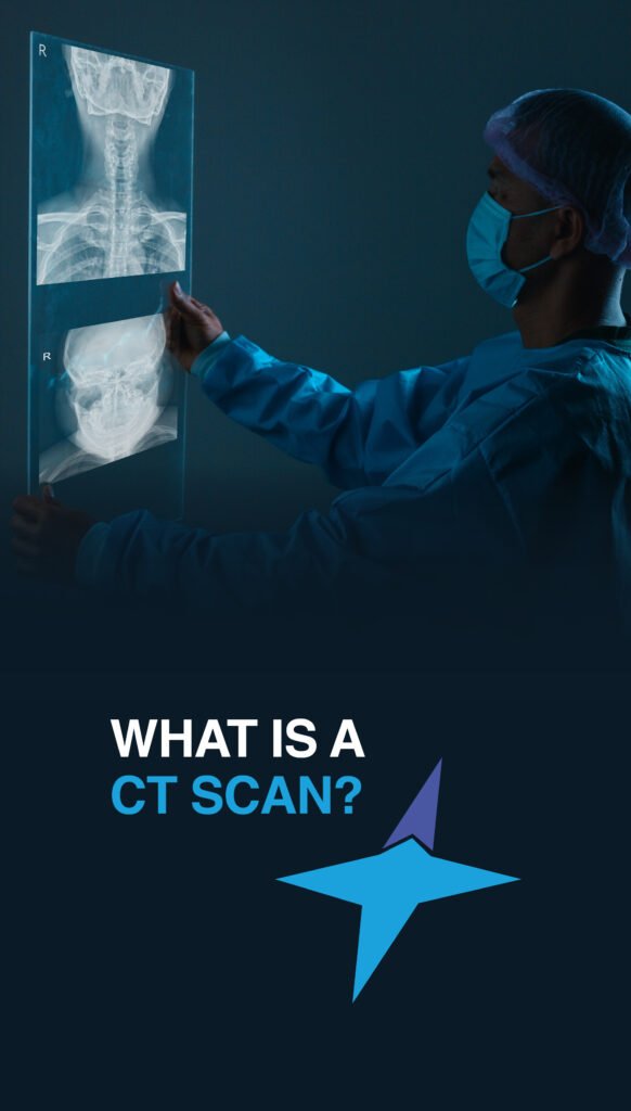 WHAT IS A CT SCAN?