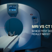 MRI Vs CT Scan: Which Test Do You Really Need? MRI Vs CT Scan: Which Test Do You Really Need?